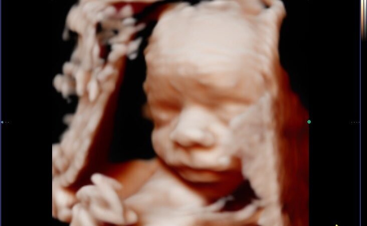 ¿Cuándo hacer la ecografía 5D? La mejor semana y qué ver en cada etapa del embarazo