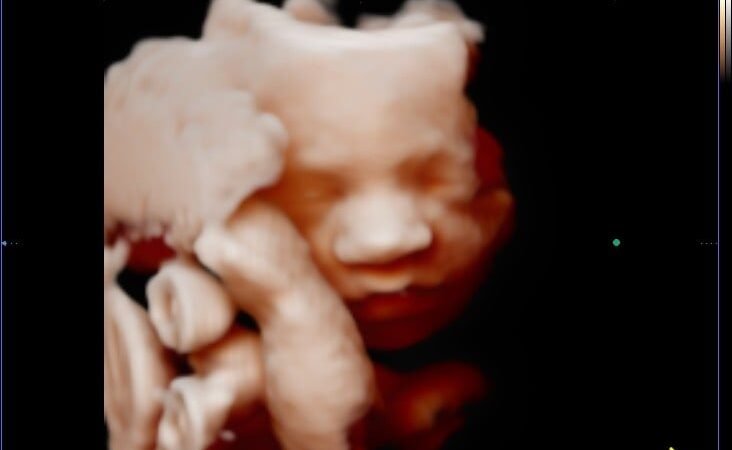 Ecografía 3D, 4D y 5D: diferencias y cuál es la mejor para ver a tu bebé